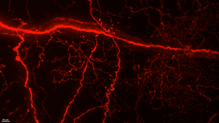 2P light sheet imaging of the atrium in an adult mouse