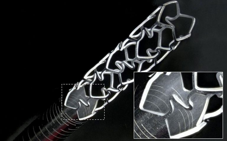 Example of stent cut from stainless steel