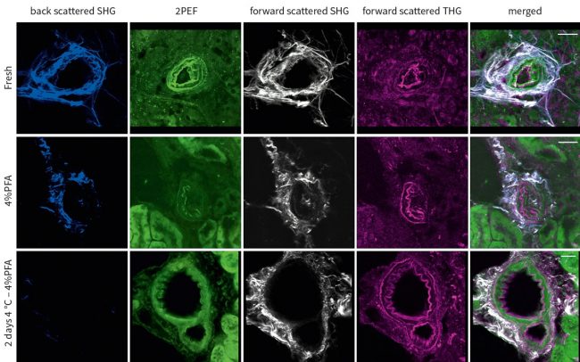 小鼠肾脏切片在经过不同处理方式后使用 CRONUS-2P 飞秒激光源观察其中胶原蛋白的 SHG 信号和弹性蛋白的 2PEF 、 THG 信号